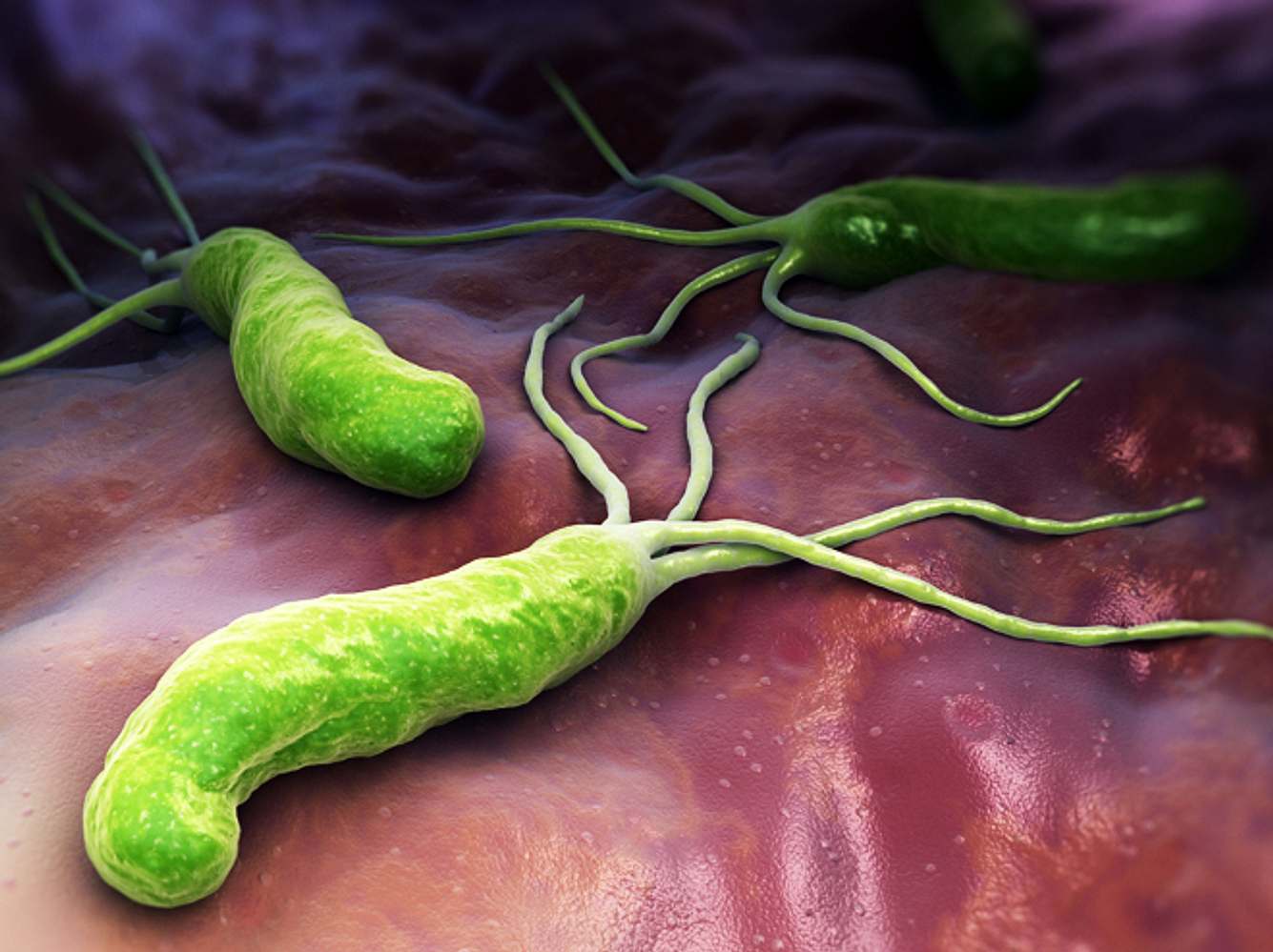 Aids als tödlichste Krankheit abgelöst: Immer mehr Menschen sterben an Atemwegsinfektionen Aids als tödlichste Krankheit abgelöst: Immer mehr Menschen sterben an Atemwegsinfektionen