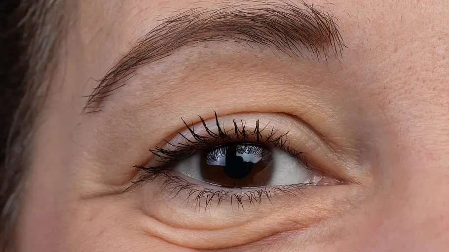 Nahaufnahme Auge & Schlupflider Nahaufnahme Auge & Schlupflider