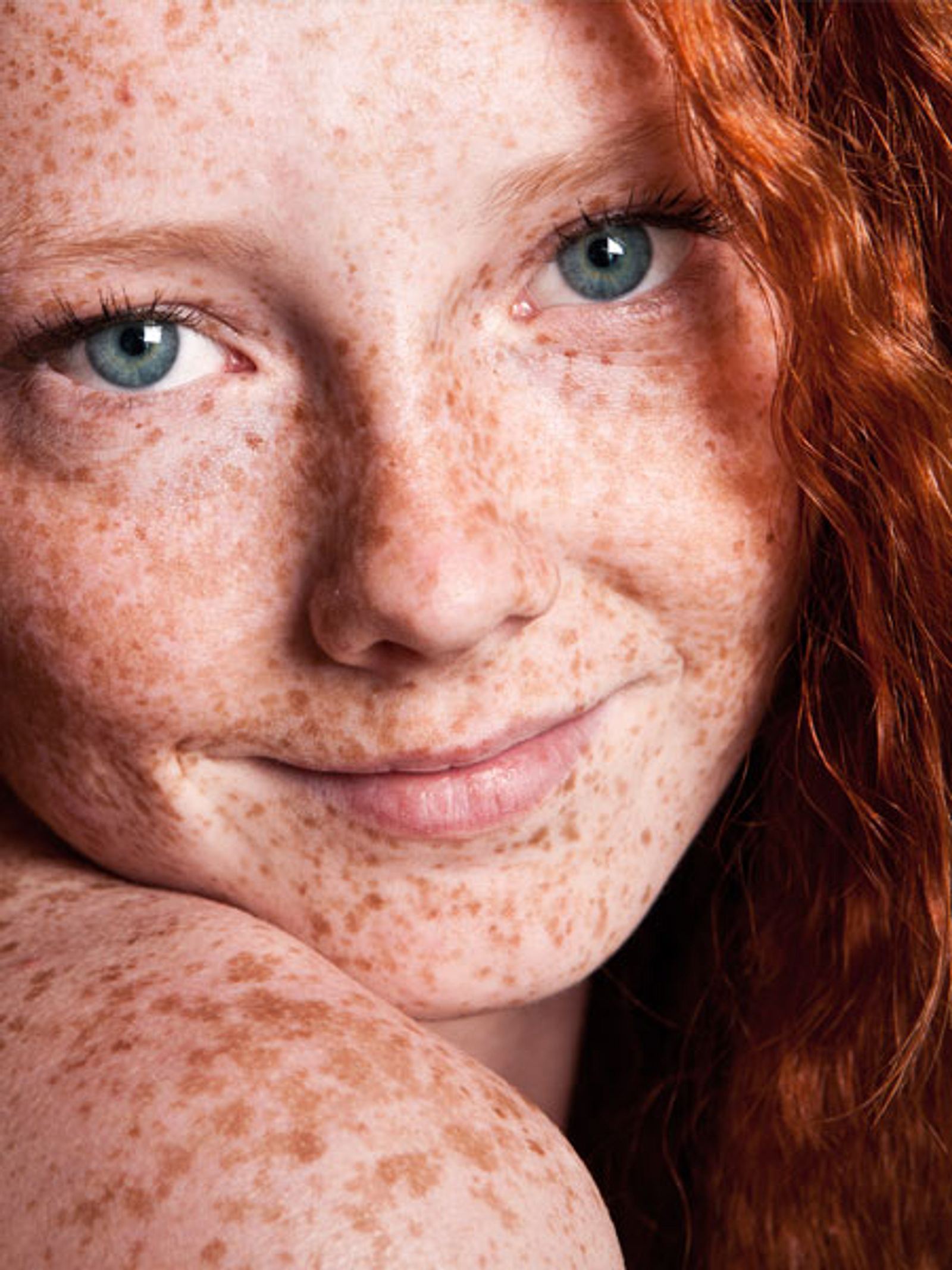 Freckles Tgp