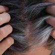Frau zeigt den Scheitel ihrer Haare (Themenbild) - Foto: Professor25/iStock