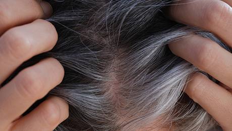 Frau zeigt den Scheitel ihrer Haare (Themenbild) - Foto: Professor25/iStock