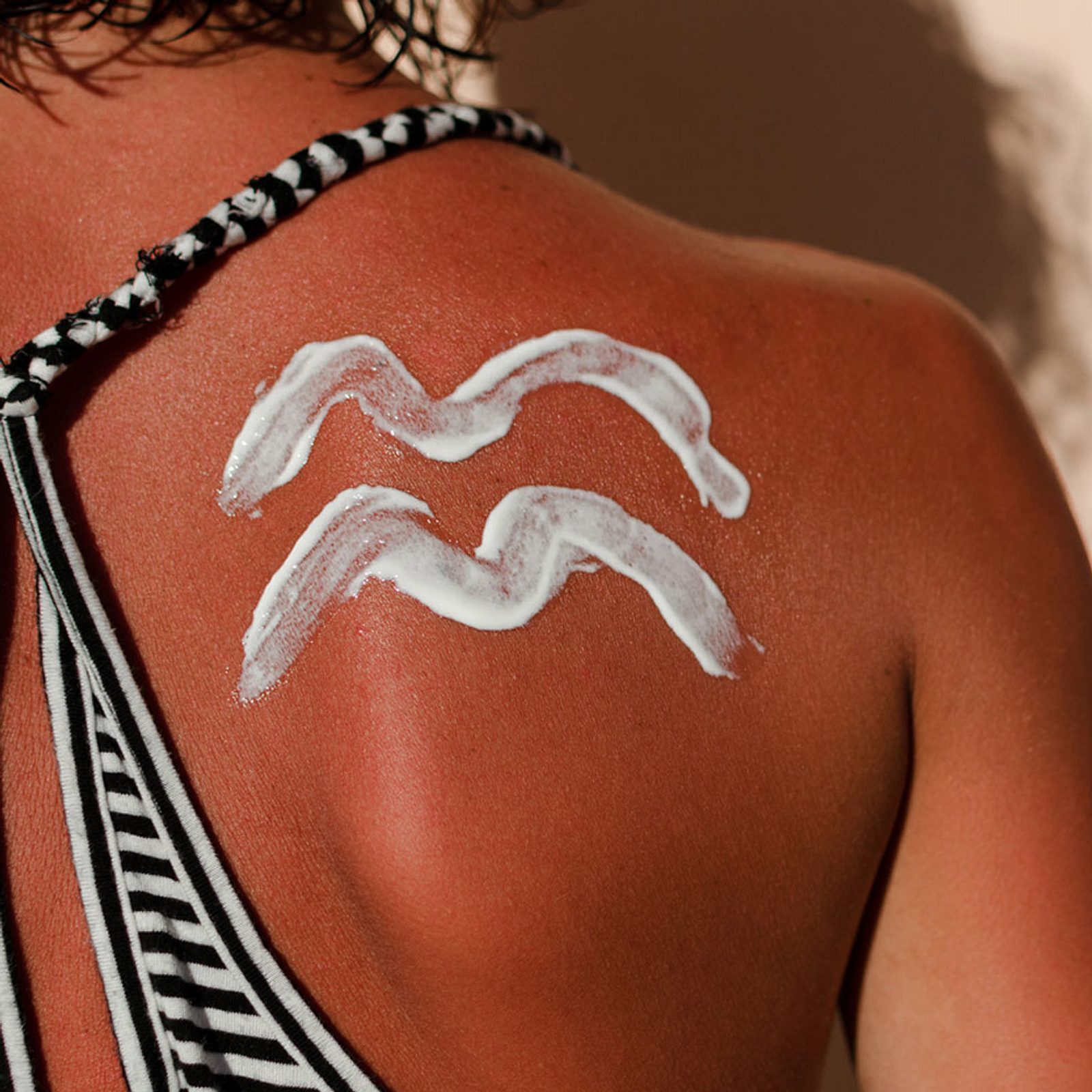 Sonnenbrand-Tattoos: So gefährlich ist der Beauty-Trend | Wunderweib |  Wunderweib
