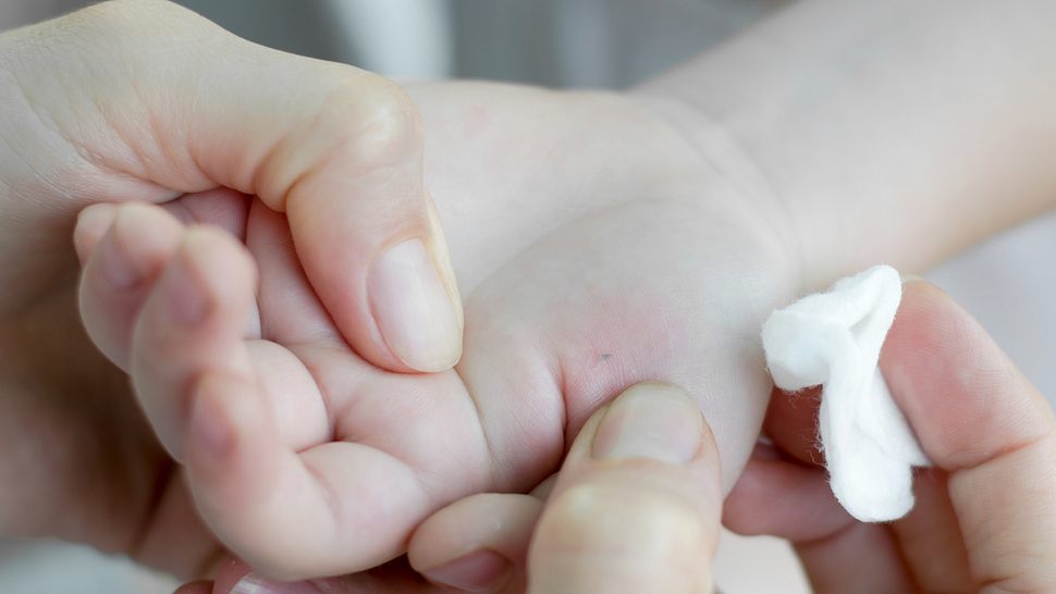 Splitter in der Hand eines Kindes wird von einer Frau desinfiziert (Themenbild) - Foto: Oleksandr Shatyrov/iStock