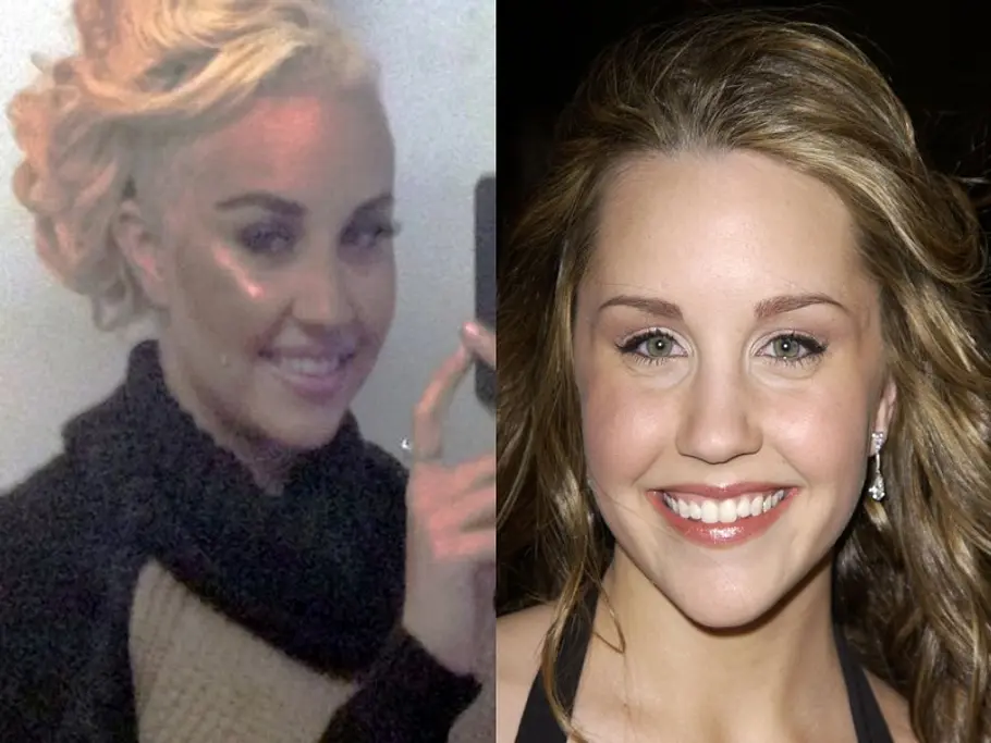 stars vor und nach der schoenheitsoperation amanda bynes