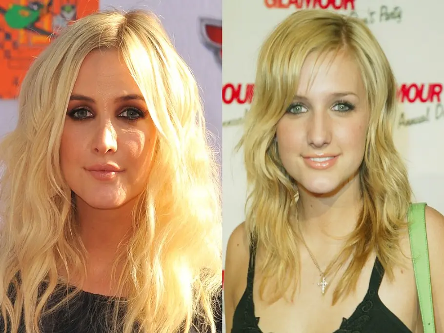 stars vor und nach der schoenheitsoperation ashlee simpson