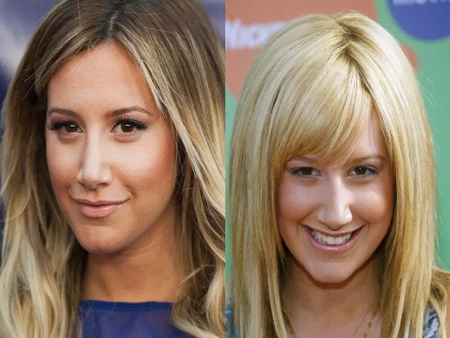 stars vor und nach der schoenheitsoperation ashley tisdale