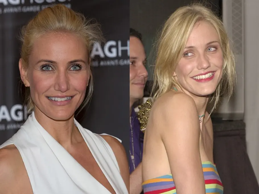 stars vor und nach der schoenheitsoperation cameron diaz