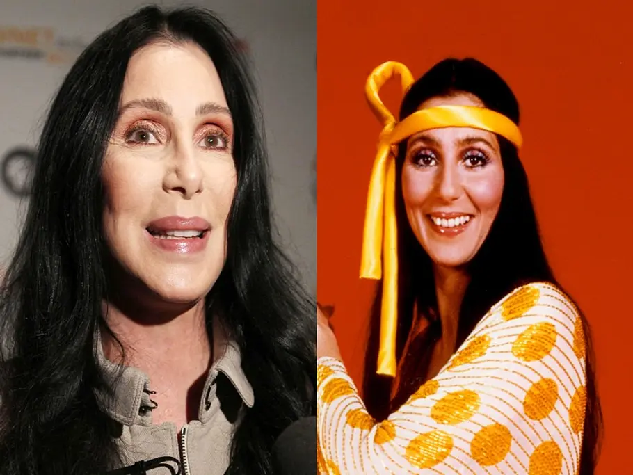 stars vor und nach der schoenheitsoperation cher