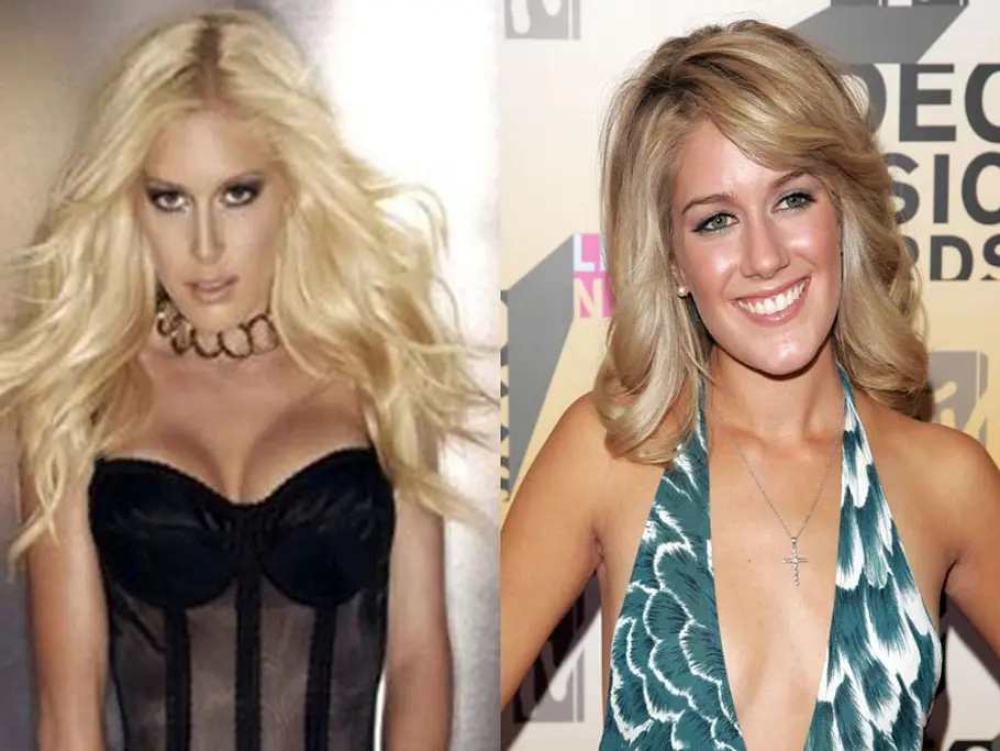 stars vor und nach der schoenheitsoperation heidi montag