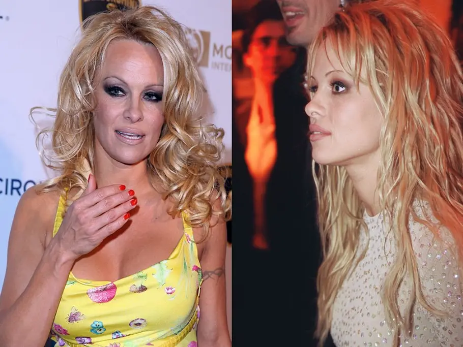 stars vor und nach der schoenheitsoperation pamela anderson
