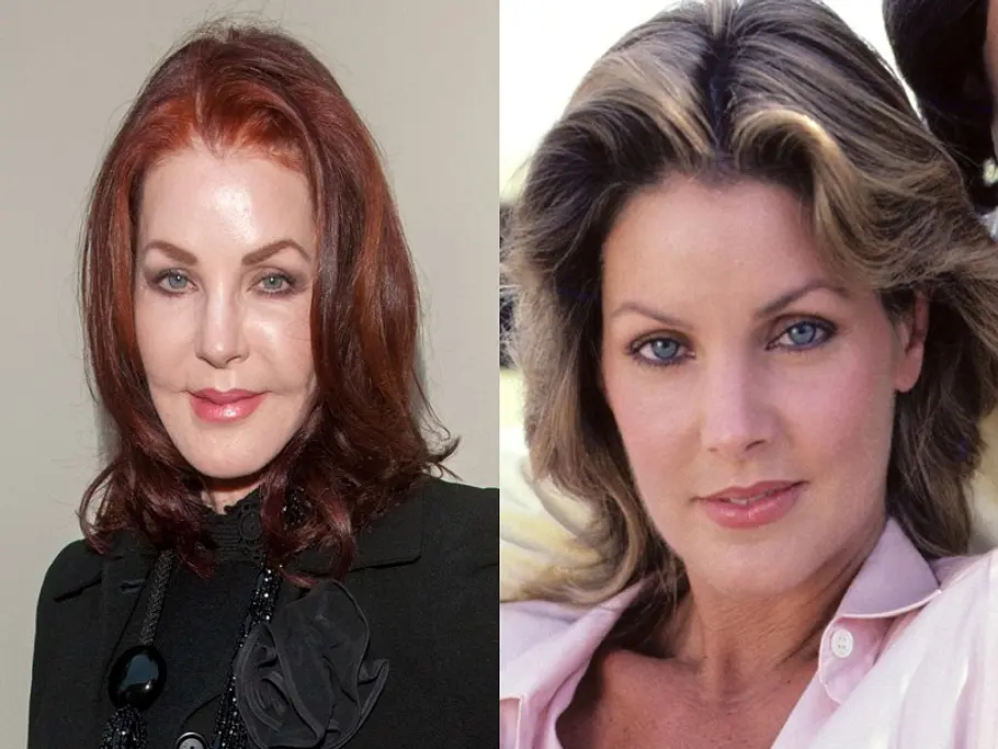 stars vor und nach der schoenheitsoperation priscilla presley