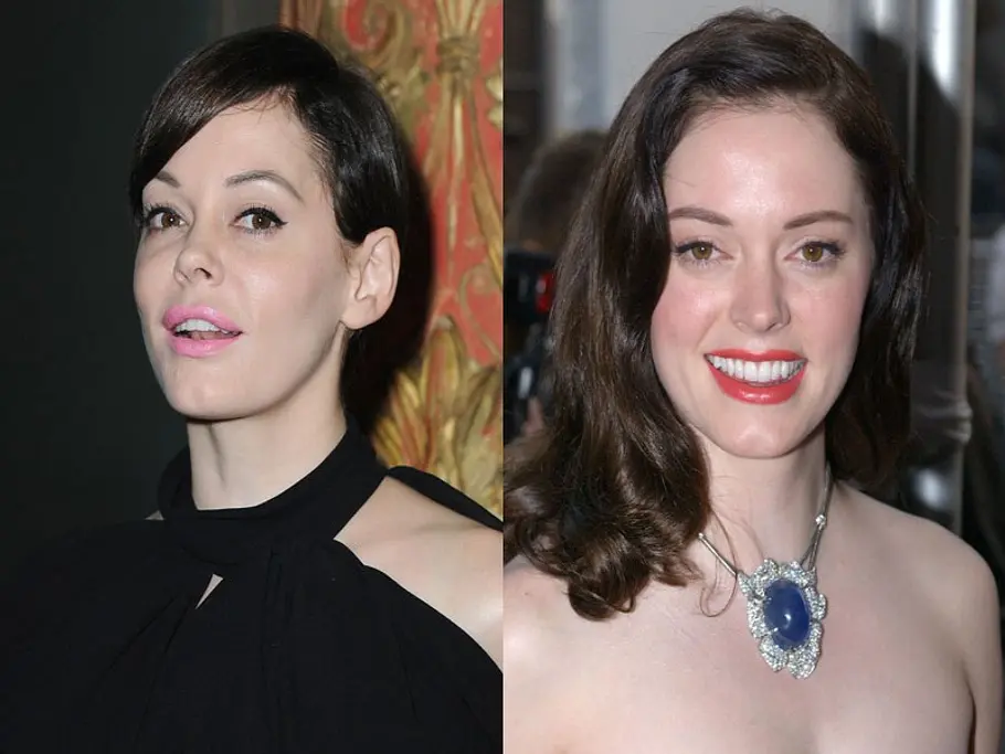 stars vor und nach der schoenheitsoperation rose mcgowan