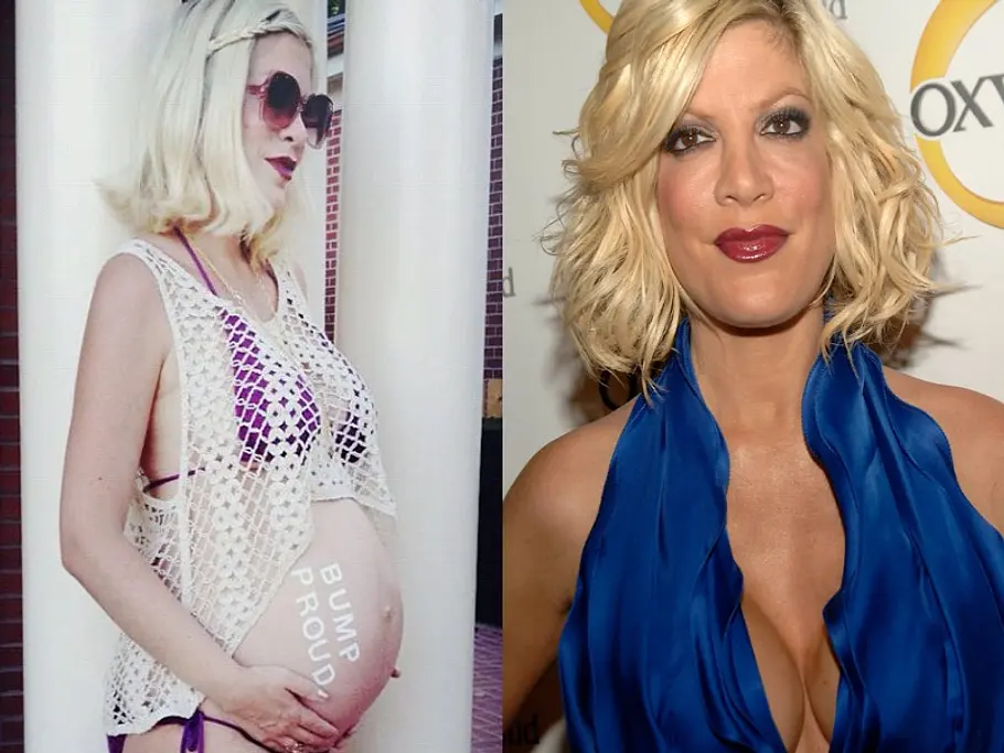 stars vor und nach der schoenheitsoperation tori spelling