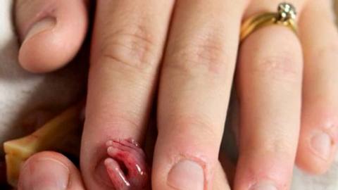 Alexis und Joshua Fretz haben ein Kind verloren und teilen die Bilder, um andere Babys zu retten. - Foto: Alexis Fretz