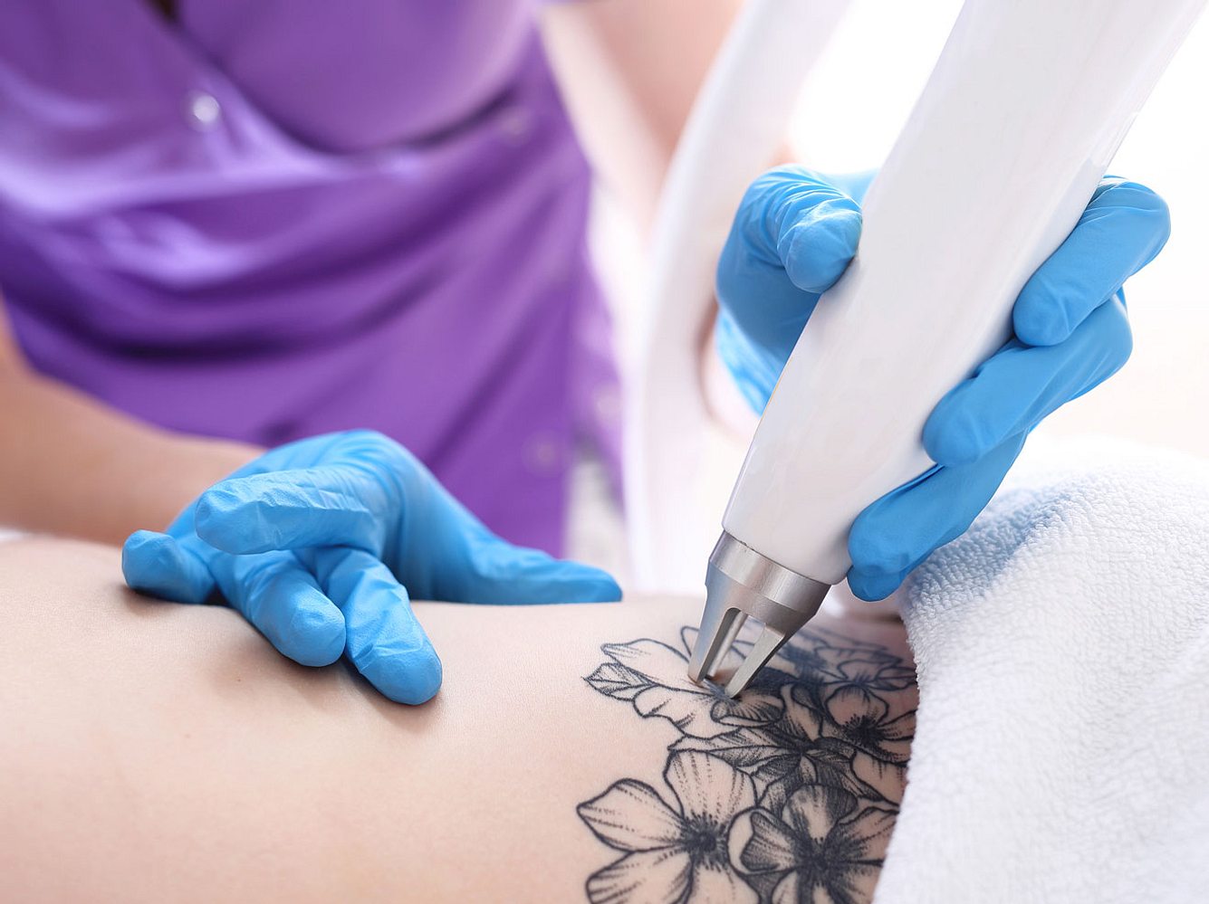 Tattoo entfernen Laser, Cremes, CoverUp&hellip; diese Möglichkeiten gibt