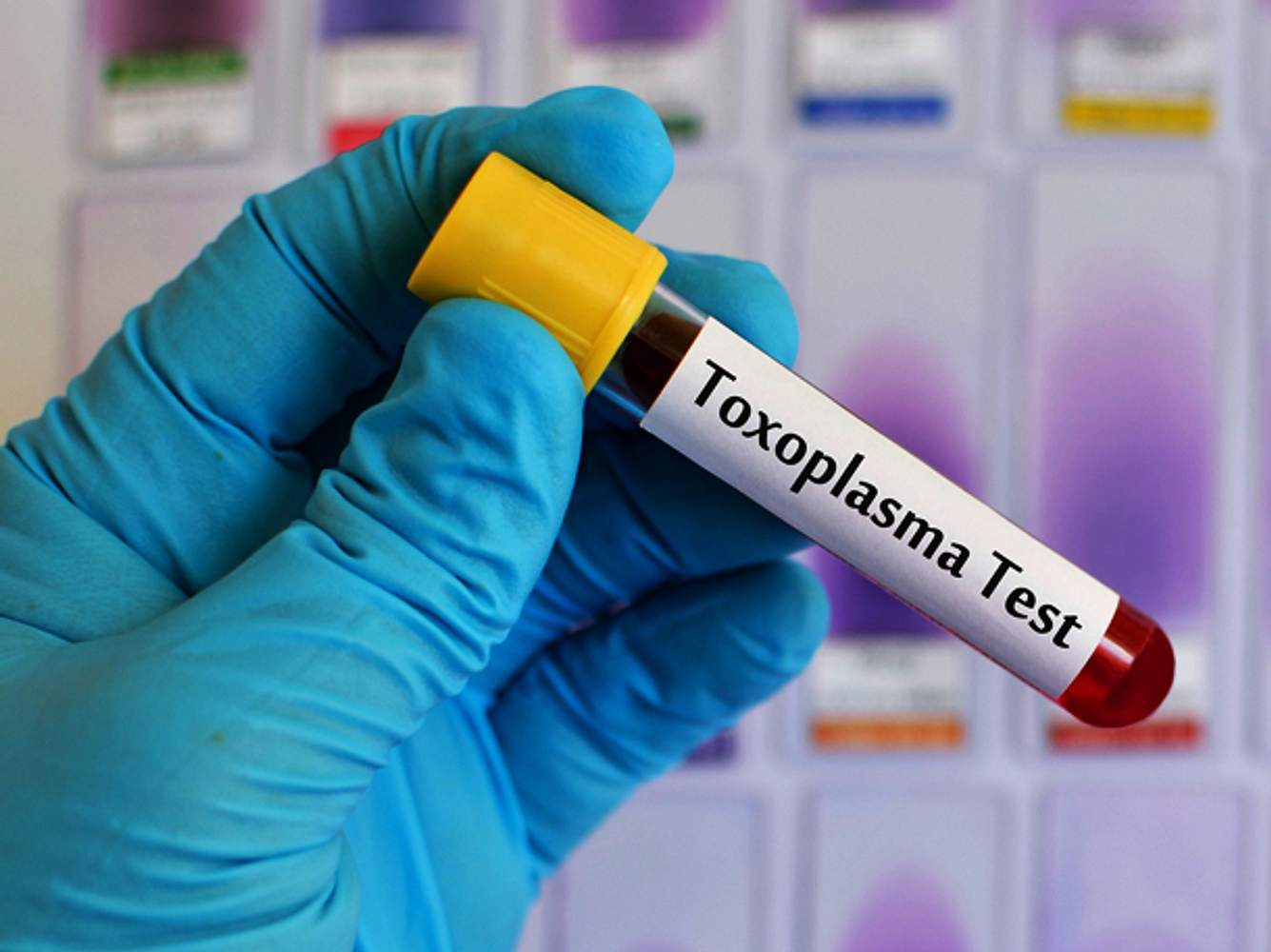 Toxoplasmose: Entstehung, Übertragung, Behandlung Toxoplasmose: Entstehung, Übertragung, Behandlung