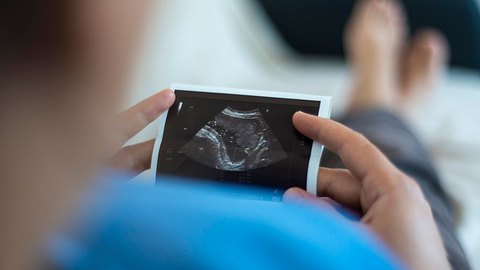 Ultraschalluntersuchungen: Babykino ab 2021 verboten - Foto: iStock