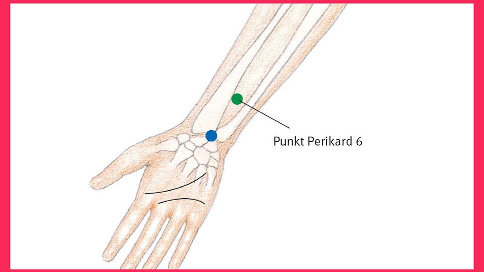 Grafische Darstellung eines Arms mit Knochen und Anzeige des Punkts Perikard 6 unterhalb des Handgelenks (Themenbild) - Foto: © Grafikbüro Schaaf, Karlsruhe; Gisela Rüger, München; Holger Vanselow, Stuttgart, TRIAS Verlag
