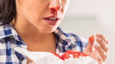 Was tun bei Nasenbluten? Hausmittel und Tipps zum Stoppen der Blutung können helfen. (Themenbild) - Foto: MarianVejcik/iStock