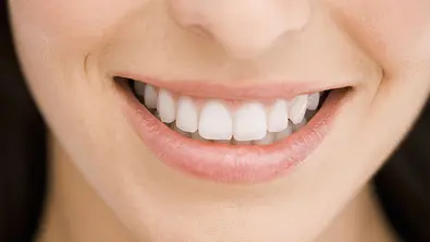 was zaehne im traum bedeuten - Foto: Thinkstock
