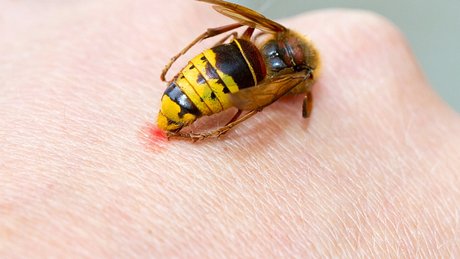 Wespenstichallergie: Wespenstiche können besonders für Allergiker lebensgefährliche Folgen haben. - Foto: fotojog/iStock