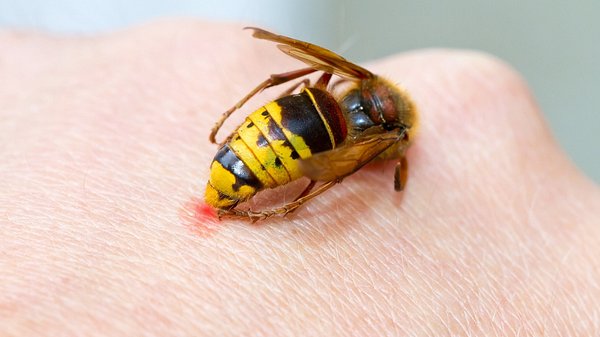 Wespe sticht in Hand (Themenbild) - Foto: fotojog/iStock