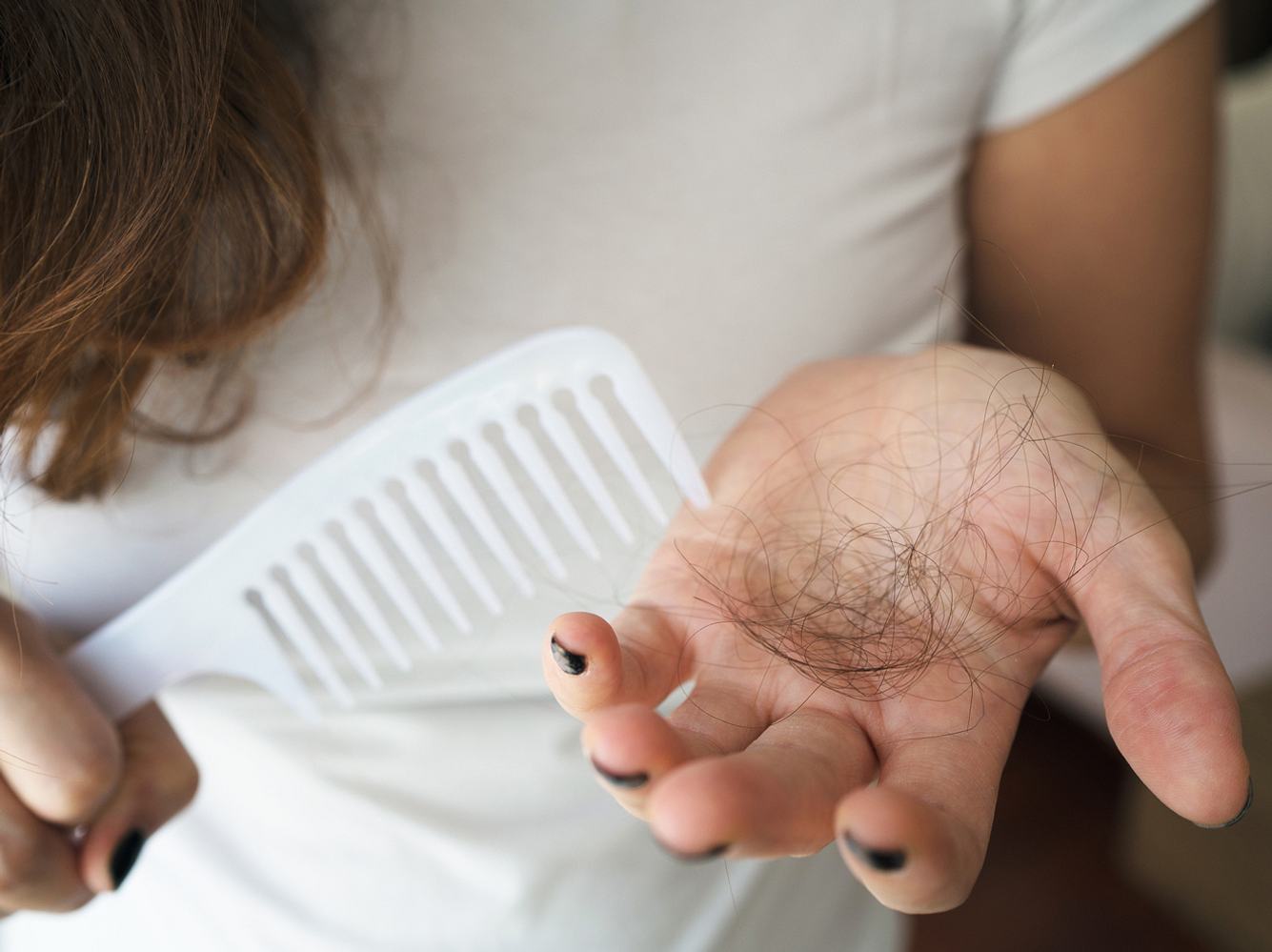 Wie viel Haarverlust ist normal?