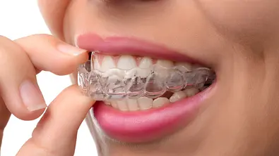 Gefährlicher Trend: Immer mehr Menschen richten ihre Zähne selbst - Foto: Istock