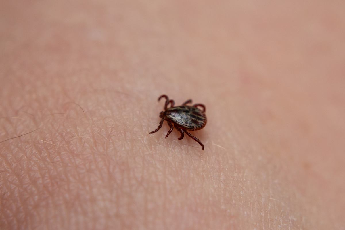 Nahaufnahme einer Zecke, die auf dem Arm einer Person kriecht.