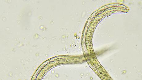 Zerkarien sind die Larven von Saugwürmern und leben oft in Badeseen. - Foto: iStock
