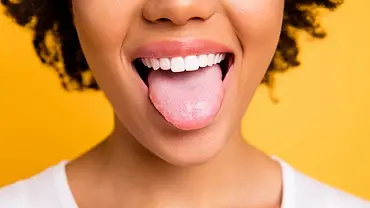 Zunge verbrannt? Das kannst du dagegen tun! - Foto: Deagreez/iStock Zunge verbrannt? Das kannst du dagegen tun! - Foto: Deagreez/iStock